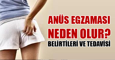 anus-egzamasi-neden-olur