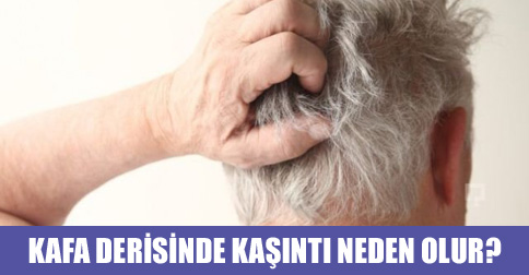 kafa derisi kaşıntısı